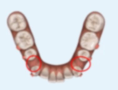 ĺ